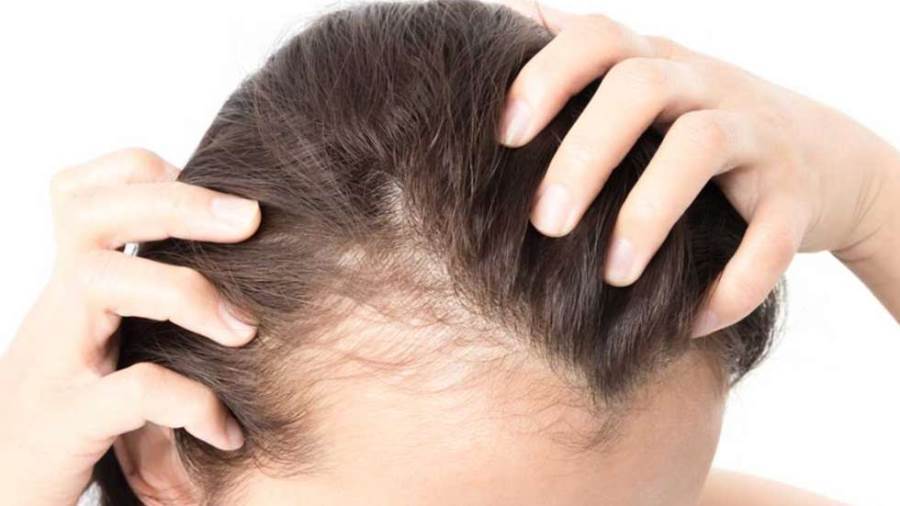 Hair transplantation in Turkey