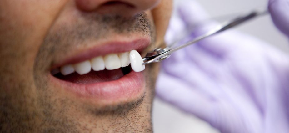 Cosmetic dentistry in Turkey