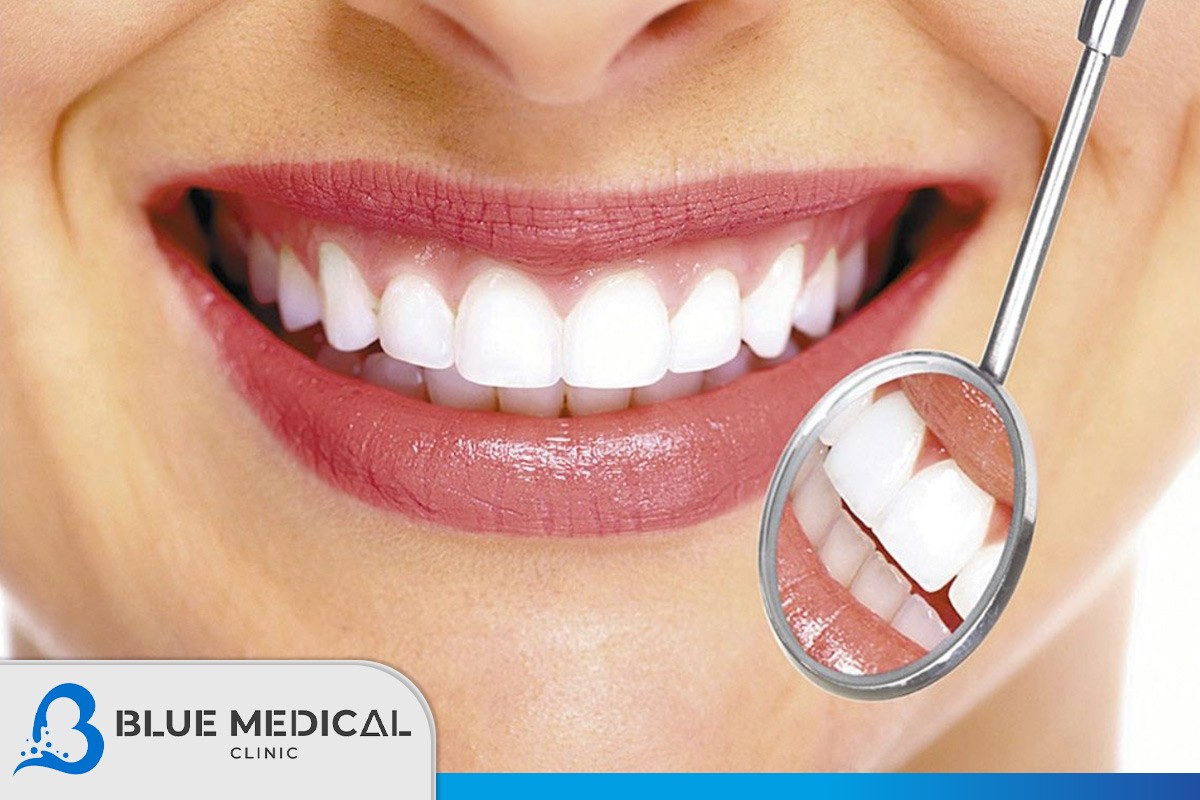 cosmetic dentistry in Turkey