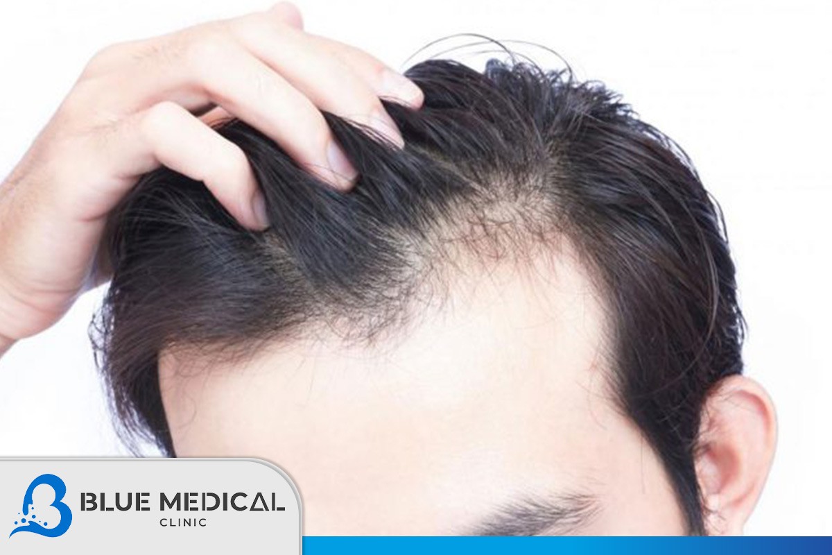 مخاطر-زراعة-الشعر